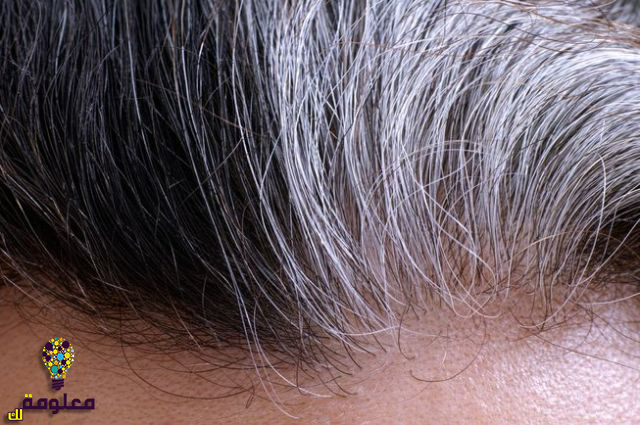 طرق علاج الشعر الابيض والتخلص منه نهائيًا
