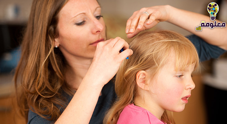 علاج القمل في الشعر للاطفال