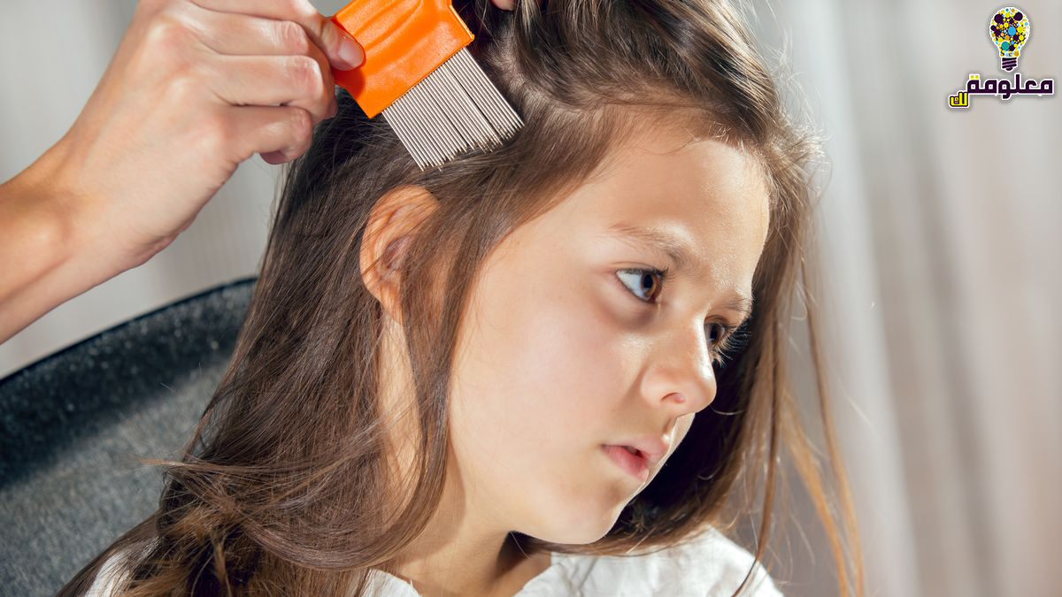 علاج القمل في الشعر للاطفال